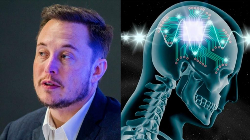 Neuralink, Elon Musk pronto ai test del chip nel cervello umano